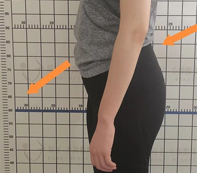 Posterior Pelvic Tilt Assessment: Clinical Insight, Commercial Value, and Corrective Applications