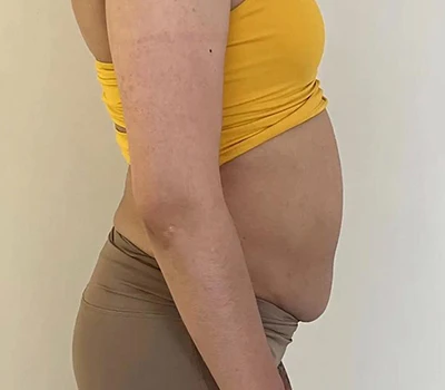 How Modern Recovery Brands Build Scalable, Differentiated, and Data-Driven Postnatal Services