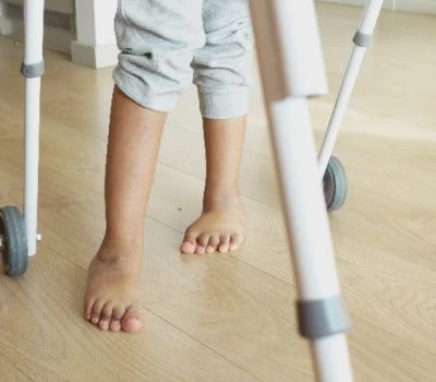Leg Length Discrepancy: Understanding Imbalance, Recognizing Harm, And Finding Clarity With 3D Bo...