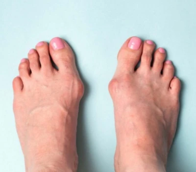 The Silent Epidemic: Children’s Foot Problems Are More Common Than You Think