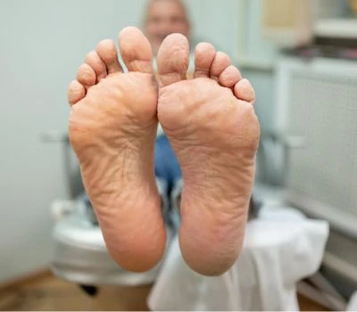 Age-Related Arch Collapse Screening And Fall Prevention Via 3D Foot Scanning