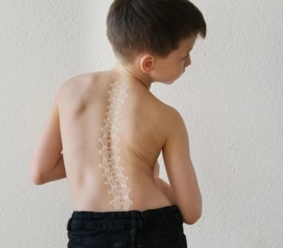 Is Screen Time Reshaping A Generation's Spine?