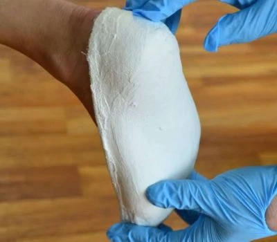 How Will 3D Foot Scanners Transform The Future Of Orthopedic Support Devices?