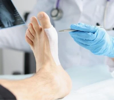 Recovery Begins Before The Injury Happens