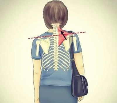 Is Your Shoulder Imbalance Caused By Your Bag? How One-Sided Carrying Affects Your Body Posture