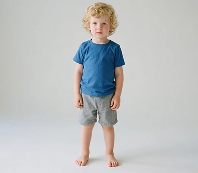 Flat Feet: The Silent Health Threat