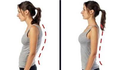 Posture Management: How Xianku3d Body Scanner Addresses Critical Challenges in The U.S. Posture M...