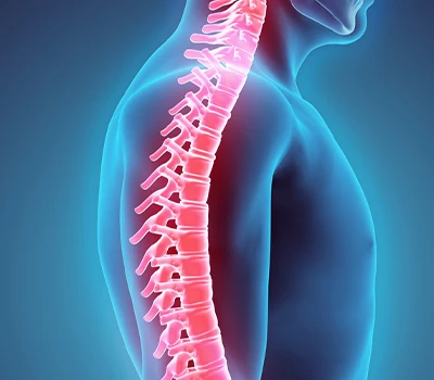 Spinal Correction:Radiation-free Digital Spine Solution