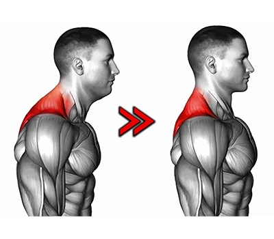 Understanding Forward Head Posture: Causes, Health Implications, And Technology-Driven Solutions