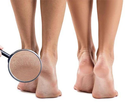 Stepping Into The Future: How 3D Foot Scanning Technology Is Revolutionizing Podiatry Care
