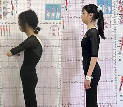 3D Posture Scanning Vs. Traditional Assessment: Why The Naked Eye Misses Critical Issues